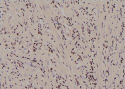Invitrogen Phospho-FER (Tyr497) Polyclonal Antibody 100 &mu;L; Unconjugated:Antibodies,