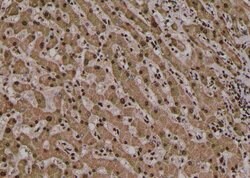 Invitrogen Phospho-PLCG2 (Tyr1245) Polyclonal Antibody 100 μL; Unconjugated:Antibodies,