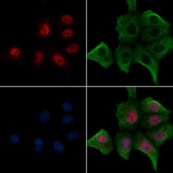 Invitrogen Phospho-JunB (Thr255) Polyclonal Antibody 100 &mu;L | Buy Online | Invitrogen&trade; | Fisher Scientific