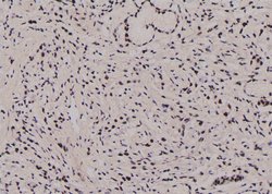 Invitrogen Phospho-JunB (Thr255) Polyclonal Antibody 100 &mu;L | Buy Online | Invitrogen&trade; | Fisher Scientific
