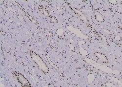 Invitrogen Phospho-JunB (Thr255) Polyclonal Antibody 100 &mu;L | Buy Online | Invitrogen&trade; | Fisher Scientific