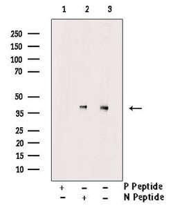 Invitrogen Phospho-JunB (Thr255) Polyclonal Antibody 100 &mu;L | Buy Online | Invitrogen&trade; | Fisher Scientific