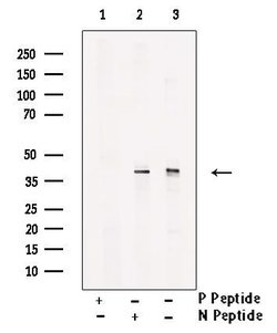 Invitrogen Phospho-JunB (Ser259) Polyclonal Antibody 100 &mu;L; Unconjugated:Antibodies,