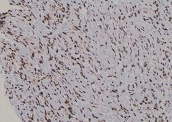 Invitrogen Phospho-UBF-1 (Thr117) Polyclonal Antibody 100 &mu;L | Buy Online | Invitrogen&trade; | Fisher Scientific