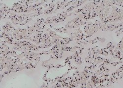 Invitrogen Phospho-UBF-1 (Thr117) Polyclonal Antibody 100 &mu;L | Buy Online | Invitrogen&trade; | Fisher Scientific