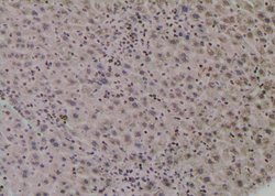 Invitrogen Phospho-UBF-1 (Thr117) Polyclonal Antibody 100 &mu;L | Buy Online | Invitrogen&trade; | Fisher Scientific