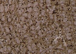 Invitrogen Phospho-Synapsin 1 (Ser427) Polyclonal Antibody 100 &mu;L | Buy Online | Invitrogen&trade; | Fisher Scientific