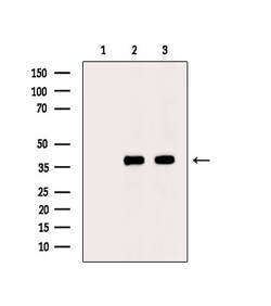 Phospho-PKA alpha/beta/gamma (Thr198) Polyclonal Antibody, Invitrogen 100