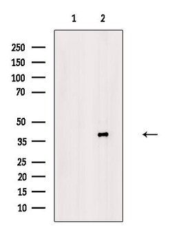 Phospho-PKA alpha/beta/gamma (Thr198) Polyclonal Antibody, Invitrogen 100