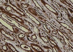 Phospho-PKA alpha/beta/gamma (Thr198) Polyclonal Antibody, Invitrogen 100