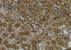 Phospho-PKA alpha/beta/gamma (Thr198) Polyclonal Antibody, Invitrogen 100