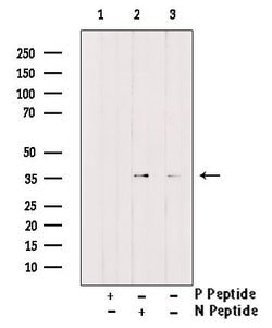 Invitrogen Phospho-C/EBP beta (Ser76) Polyclonal Antibody 100 &mu;L; Unconjugated:Antibodies,