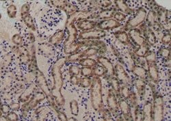 Invitrogen Phospho-VEGF Receptor 1 (Tyr1048) Polyclonal Antibody 100 &mu;L;