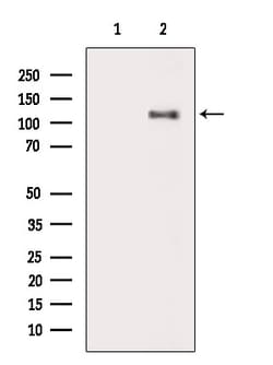 Phospho-Vinculin (Tyr692) Polyclonal Antibody