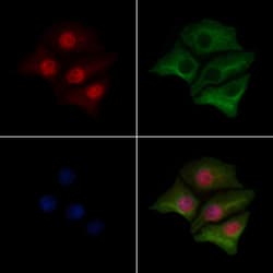 Invitrogen Phospho-ATF1 (Ser198) Polyclonal Antibody 100 &mu;L | Buy Online | Invitrogen&trade; | Fisher Scientific