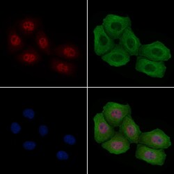 Invitrogen Phospho-ATF1 (Ser198) Polyclonal Antibody 100 &mu;L | Buy Online | Invitrogen&trade; | Fisher Scientific