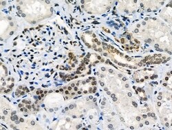 Invitrogen Phospho-ATF1 (Ser198) Polyclonal Antibody 100 &mu;L | Buy Online | Invitrogen&trade; | Fisher Scientific