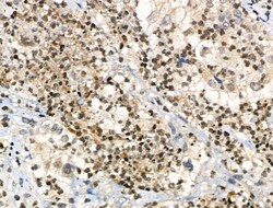 Invitrogen Phospho-ATF1 (Ser198) Polyclonal Antibody 100 &mu;L | Buy Online | Invitrogen&trade; | Fisher Scientific