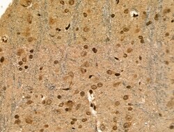 Invitrogen Phospho-ATF1 (Ser198) Polyclonal Antibody 100 &mu;L | Buy Online | Invitrogen&trade; | Fisher Scientific