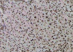 Invitrogen Phospho-ATF1 (Ser198) Polyclonal Antibody 100 &mu;L | Buy Online | Invitrogen&trade; | Fisher Scientific