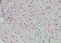 Invitrogen Phospho-ATF1 (Ser198) Polyclonal Antibody 100 &mu;L | Buy Online | Invitrogen&trade; | Fisher Scientific