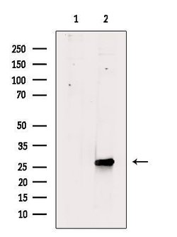 Invitrogen Phospho-ATF1 (Ser198) Polyclonal Antibody 100 &mu;L | Buy Online | Invitrogen&trade; | Fisher Scientific