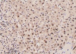 Invitrogen Phospho-PLCG1 (Tyr977) Polyclonal Antibody 100 &mu;L | Buy Online | Invitrogen&trade; | Fisher Scientific