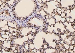 Invitrogen Phospho-PLCG1 (Tyr977) Polyclonal Antibody 100 &mu;L | Buy Online | Invitrogen&trade; | Fisher Scientific