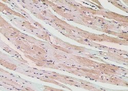 Invitrogen Phospho-PLCG1 (Tyr472) Polyclonal Antibody 100 &mu;L; Unconjugated:Antibodies,