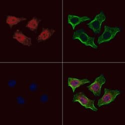 Invitrogen Phospho-MAK (Thr157) Polyclonal Antibody 100 &mu;L; Unconjugated:Antibodies,