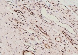 Invitrogen Phospho-MAK (Thr157) Polyclonal Antibody 100 &mu;L; Unconjugated:Antibodies,