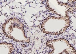 Invitrogen Phospho-MAK (Thr157) Polyclonal Antibody 100 &mu;L; Unconjugated:Antibodies,