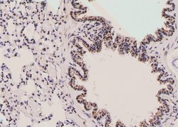 Invitrogen Phospho-MAK (Thr157) Polyclonal Antibody 100 &mu;L; Unconjugated:Antibodies,