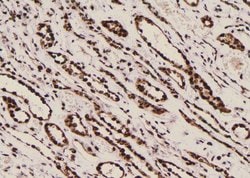 Invitrogen Phospho-Filamin A (Tyr1604) Polyclonal Antibody 100 &mu;L; Unconjugated:Antibodies,