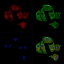 Invitrogen Phospho-FGFR4 (Tyr642) Polyclonal Antibody 100 μL; Unconjugated:Antibodies,