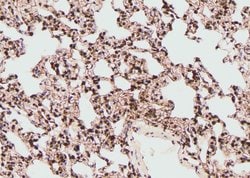 Invitrogen Phospho-FGFR4 (Tyr642) Polyclonal Antibody 100 μL; Unconjugated:Antibodies,
