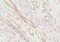 Invitrogen Phospho-c-Cbl (Ser767) Polyclonal Antibody 100 &mu;L | Buy Online | Invitrogen&trade; | Fisher Scientific