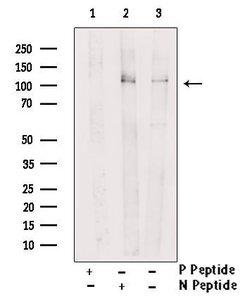 Invitrogen Phospho-c-Cbl (Ser767) Polyclonal Antibody 100 &mu;L | Buy Online | Invitrogen&trade; | Fisher Scientific