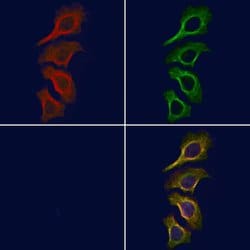 Invitrogen Phospho-JAK1 (Tyr1125) Polyclonal Antibody 100 &mu;L | Buy Online | Invitrogen&trade; | Fisher Scientific