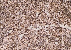 Invitrogen Phospho-JAK1 (Tyr1125) Polyclonal Antibody 100 &mu;L | Buy Online | Invitrogen&trade; | Fisher Scientific
