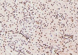 Invitrogen Phospho-JAK1 (Tyr1125) Polyclonal Antibody 100 &mu;L | Buy Online | Invitrogen&trade; | Fisher Scientific