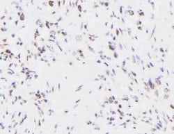 Invitrogen Phospho-EIF4B (Thr420) Polyclonal Antibody 100 &mu;L | Buy Online | Invitrogen&trade; | Fisher Scientific