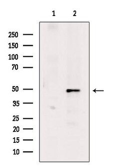 Invitrogen Phospho-GATA2 (Ser401) Polyclonal Antibody 100 &mu;L | Buy Online | Invitrogen&trade; | Fisher Scientific