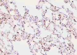 Invitrogen Phospho-IKB alpha (Tyr42) Polyclonal Antibody 100 &mu;L; Unconjugated:Antibodies,