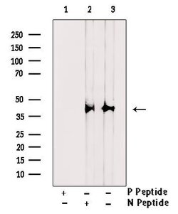 Invitrogen Phospho-IKB alpha (Tyr42) Polyclonal Antibody 100 &mu;L; Unconjugated:Antibodies,