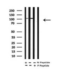 Invitrogen Phospho-EphA2 (Tyr594) Polyclonal Antibody 100 &mu;L; Unconjugated:Antibodies,