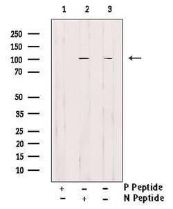 Invitrogen Phospho-EphA2 (Tyr594) Polyclonal Antibody 100 &mu;L; Unconjugated:Antibodies,