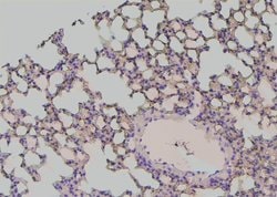 Invitrogen Phospho-EphA2 (Tyr772) Polyclonal Antibody 100 μL; Unconjugated:Antibodies,