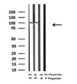 Invitrogen Phospho-EphA2 (Tyr772) Polyclonal Antibody 100 μL; Unconjugated:Antibodies,