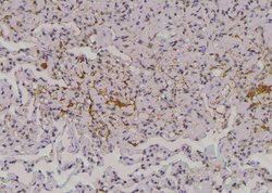 Invitrogen Phospho-EphA2 (Thr587) Polyclonal Antibody 100 &mu;L; Unconjugated:Antibodies,